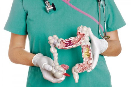 篩查揪出大腸癌 51人全無病徵