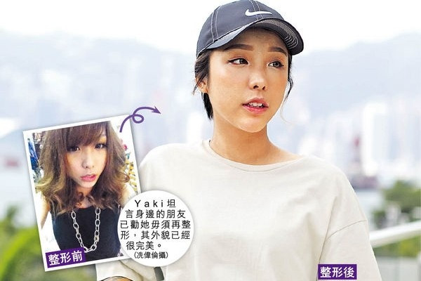 6年微整形30次 美少女告誡：太年輕勿試