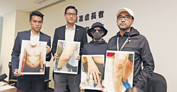 警員涉向6旬漢行私刑 3人被捕