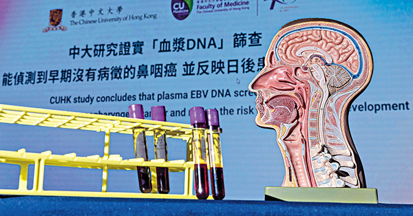 中大創驗血漿DNA 揪出無病徵鼻咽癌 2萬人篩出58確診 研公院用助及早治療