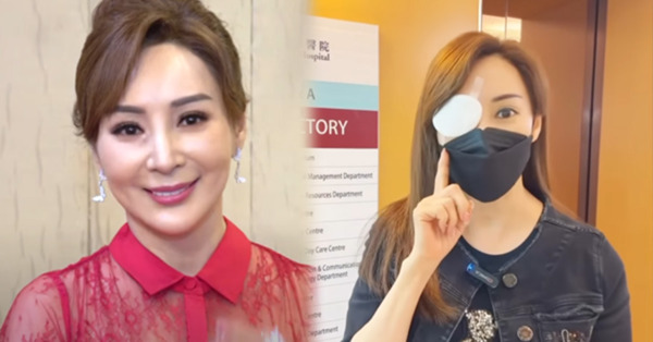 58歲羅霖患淚囊炎眼腫延醫！最終入院做手術擔心留疤