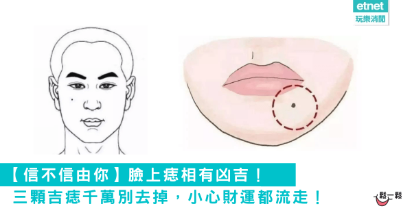 【信不信由你】臉上痣相有凶吉！三顆吉痣千萬別去掉，小心財運都流走！