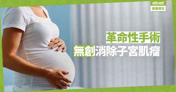 【創新技術】革命性手術！「海扶刀」無創消融子宮肌瘤，不影響懷孕機會
