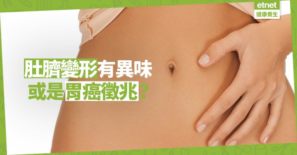 【見微知著】肚臍變形、有異味，或是胃癌徵兆？3個護理肚臍小貼士
