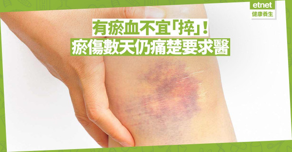 【不明瘀痕】有瘀血不宜「捽」！身體出現不明瘀血，伴隨牙齦流血、鼻血要小心！