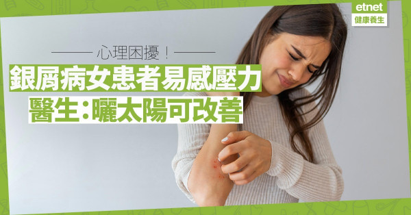 【免疫系統失調】女性患銀屑病更易焦慮，繼而加劇病情！曬太陽可改善