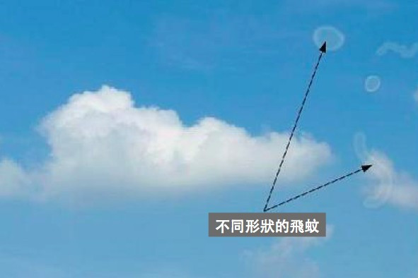 眼前有黑影？飛蚊症可大可小，不可掉以輕心