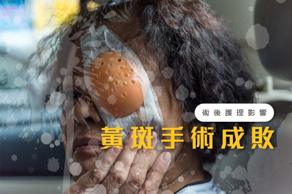【黃斑手術】趴俯姿勢助傷口復原？術後護理你要知