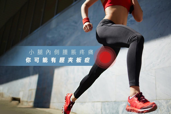 【備戰馬拉松】小腿肌過勞致脛夾板症，跑手噩夢！