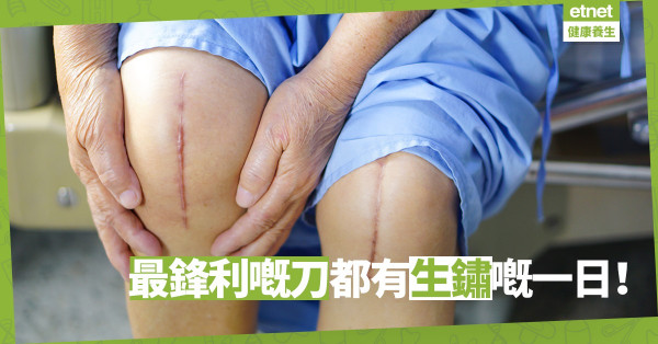 【膝關節退化】新引入微創手術：唔駛開刀、一兩日就可以出院！