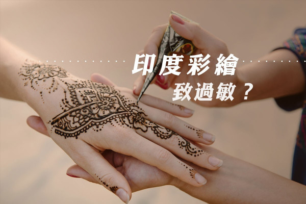 【無痛紋身？】印度彩繪致過敏紅腫，嚴重可永久留疤