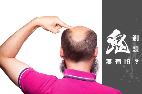 【消失的綠洲】「鬼剃頭」無有怕？4招醫學美容幫到你