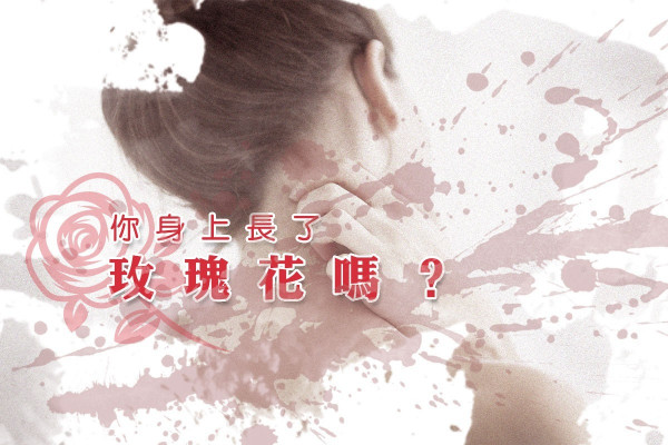 【可怕的玫瑰】皮膚痕癢脫皮？或許是「玫瑰糠疹」