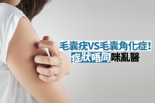 毛囊疣、毛囊角化症大有不同！醫生教你點區分