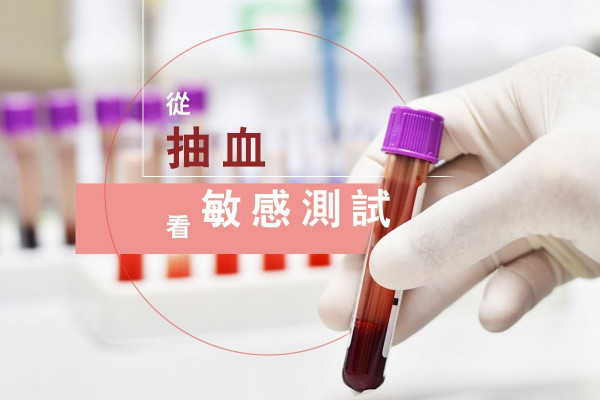 【有錢就可以做？】切記認清功用！敏感測試並非睇「划算」