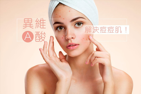 【效力愈強負作用愈大？】拆解異維A酸　解救痘痘肌