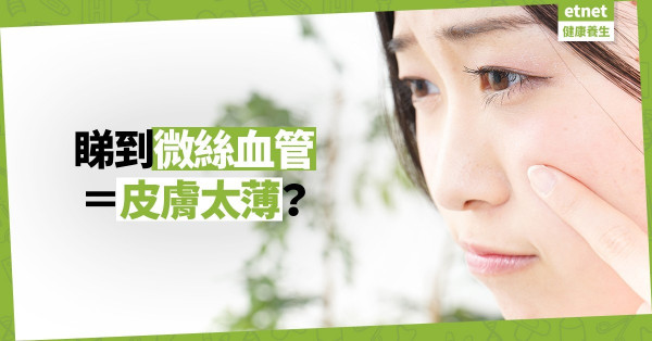 【微絲血管＝皮膚太薄？】臉上血管和皮膚厚度沒半點關係！