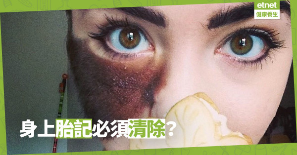【陪你長大】看不順眼胎記的人，到底是孩子還是父母？