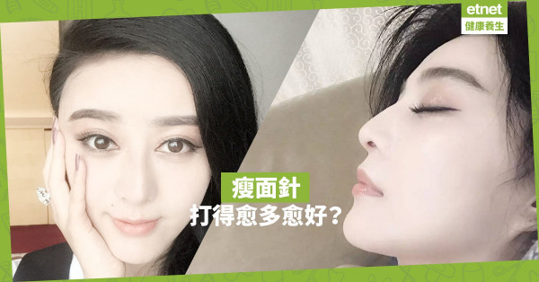 【女士注意】瘦面針過量致兩頰下陷？小顏不成反而「落曬形」