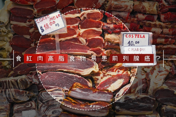 【男士殺手】紅肉高脂食物增患癌風險？醫生教你擊退前列腺癌
