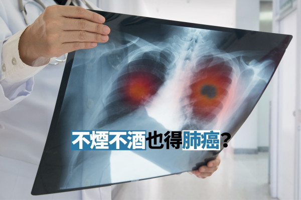 【不煙不酒】基因突變型肺癌，非吸煙人士都中招？