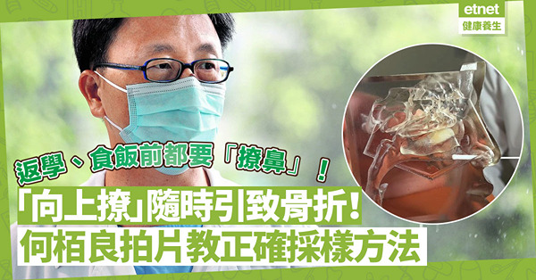 快測「撩鼻」成生活日常！何栢良教正確採樣方法：唔係向上撩！「直插」鼻孔隨時引致骨折流出腦脊髓液？（附影片）