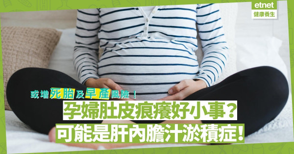 【孕婦疾病】肚皮痕癢或是妊娠期肝內膽汁淤積症！有機會增死胎及早產風險