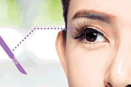 中學生也整形 少女入U前割雙眼皮  