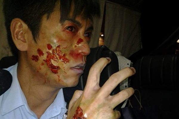 都市傳聞　瘋傳沾血警察的相片其實是….