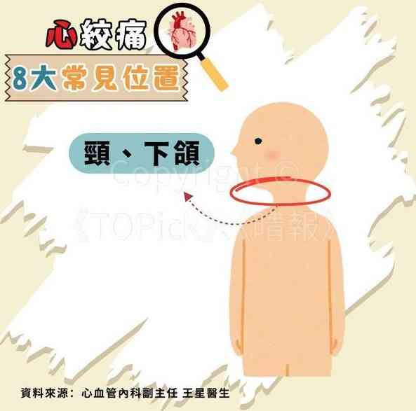 心絞痛｜67歲查小欣心絞痛入ICU　躺病床手插喉照片曝光【附醫生拆解8種心絞痛位置】