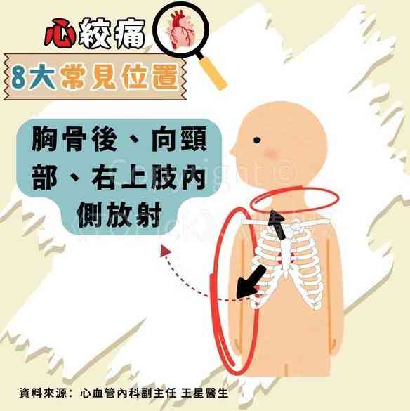 心絞痛｜67歲查小欣心絞痛入ICU　躺病床手插喉照片曝光【附醫生拆解8種心絞痛位置】