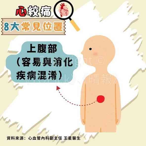 心絞痛｜67歲查小欣心絞痛入ICU　躺病床手插喉照片曝光【附醫生拆解8種心絞痛位置】