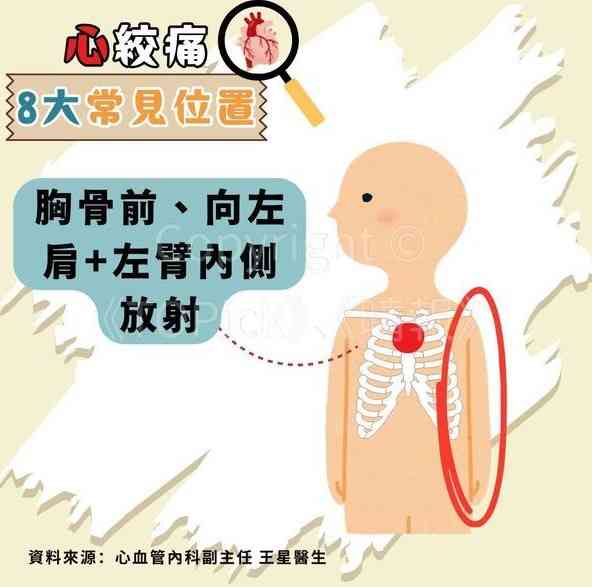 心絞痛｜67歲查小欣心絞痛入ICU　躺病床手插喉照片曝光【附醫生拆解8種心絞痛位置】