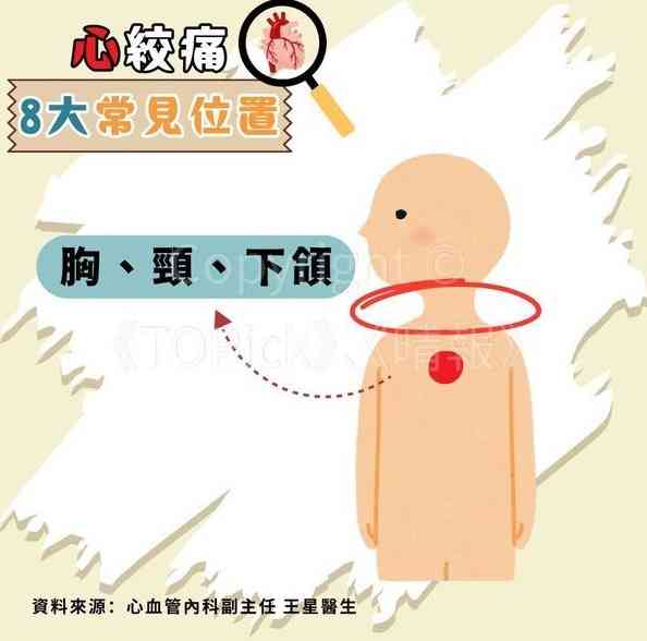 心絞痛｜67歲查小欣心絞痛入ICU　躺病床手插喉照片曝光【附醫生拆解8種心絞痛位置】