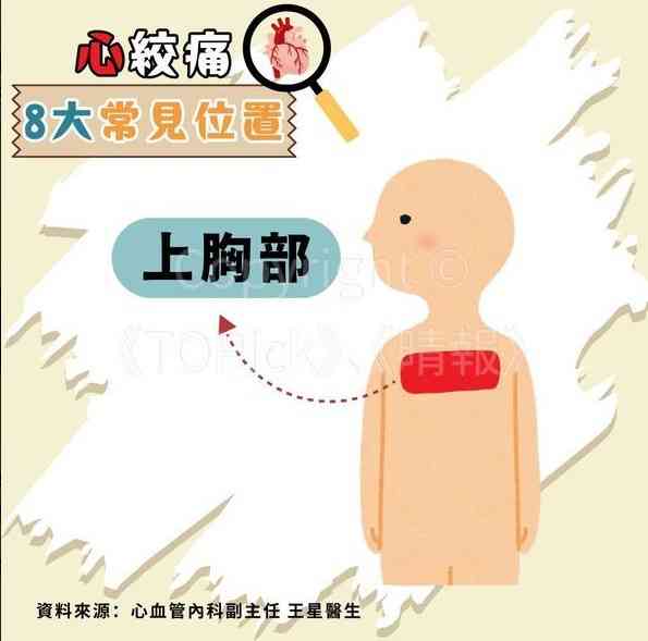 心絞痛｜67歲查小欣心絞痛入ICU　躺病床手插喉照片曝光【附醫生拆解8種心絞痛位置】