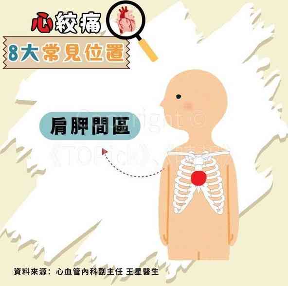 心絞痛｜67歲查小欣心絞痛入ICU　躺病床手插喉照片曝光【附醫生拆解8種心絞痛位置】