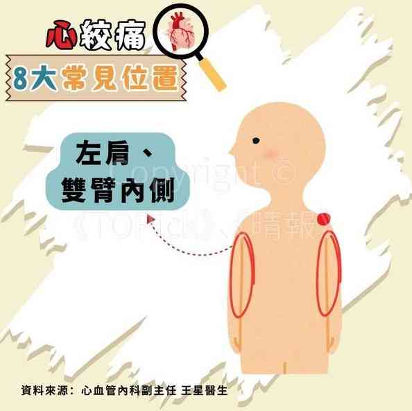 心絞痛｜67歲查小欣心絞痛入ICU　躺病床手插喉照片曝光【附醫生拆解8種心絞痛位置】