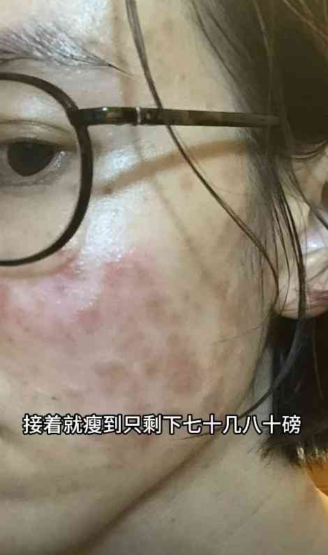 凍齡女神丨43歲前落選港姐遭「呃晒積蓄」免疫系統出問題 全身爛肉暴瘦至70多磅