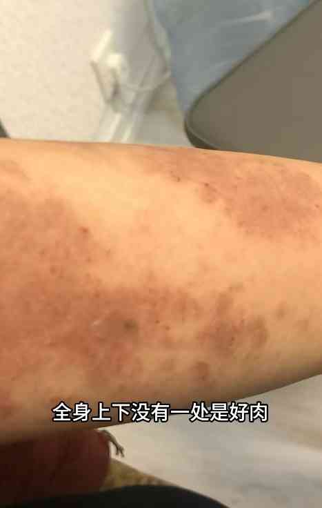 凍齡女神丨43歲前落選港姐遭「呃晒積蓄」免疫系統出問題 全身爛肉暴瘦至70多磅