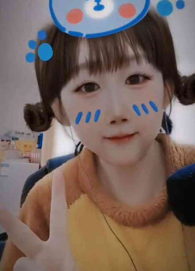 腦出血｜27歲女主播腦出血病逝　醫生拆解出血性腦中風4大症狀：不同年齡都有機會患上