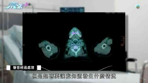東張西望｜胰臟癌母手術流血不止身亡 家屬質疑醫療事故 絕密錄音曝醫生認失誤