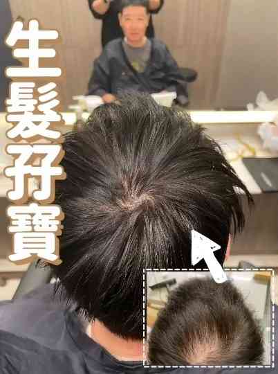 名人健康丨先後患乳癌及3期大腸癌　蘇施黃曝化療恐怖後遺症　2部位現駭人變化