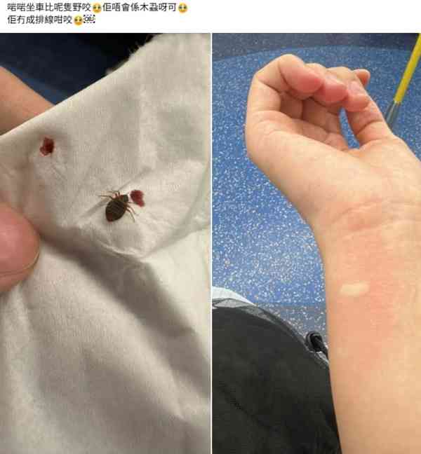 蟲出沒注意｜港鐵車廂驚現怪蟲女乘客被咬致腫脹 網民揭「恐怖真身」：立即求醫 【附港鐵回應】