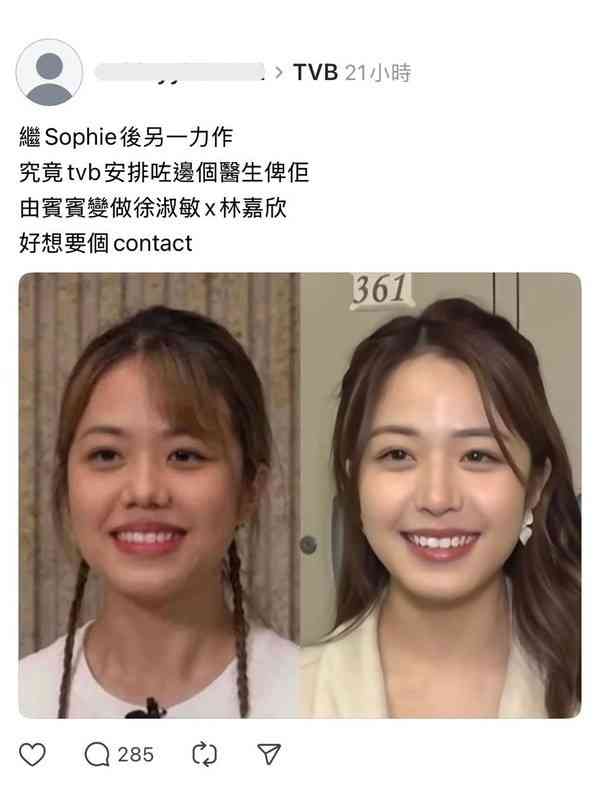 容貌進化︱港姐莊子璇近照疑容貌再進化 甩豬膽鼻變混血靚樣：似徐淑敏mix林嘉欣