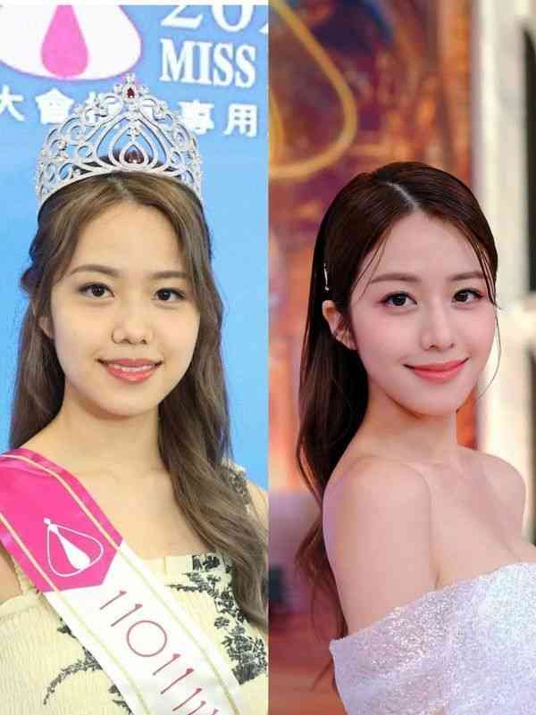 容貌進化︱港姐莊子璇近照疑容貌再進化 甩豬膽鼻變混血靚樣：似徐淑敏mix林嘉欣