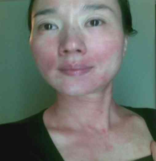 癌症殺手︱59歲歌后驚傳癌逝!生前飽受紅斑性狼瘡折磨 身價百億猶太富商老公二度喪妻 癌症殺手︱59歲歌后驚傳癌逝!生前飽受紅斑性狼瘡折磨 身價百億猶太富商老公二度喪妻