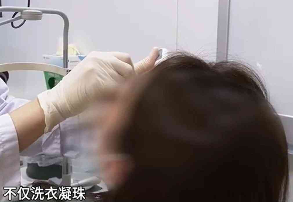 家居意外|女子用洗衣膠囊做錯1動作險盲 醫生教兩步驟急救【附消委會推薦15種洗衣產品】 家居意外|女子用洗衣膠囊做錯1動作險盲 醫生教兩步驟急救【附消委會推薦15種洗衣產品】