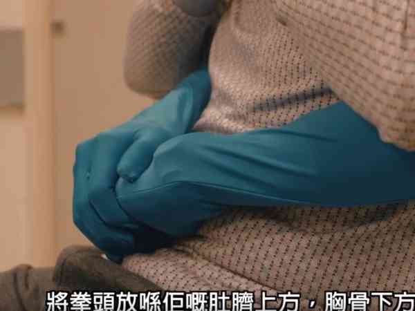 鯁喉意外｜4日4宗長者鯁喉事故　2人食燒賣、打邊爐不治　比華利山91歲婦食炒蛋鯁喉