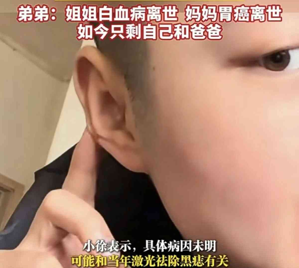 抗癌勇士｜右耳長黑痣罹黑色素瘤晚期　24歲男抗癌不到1年癌逝　生前積極抗癌：希望明年我還在【附「ABCDE」口訣自測】