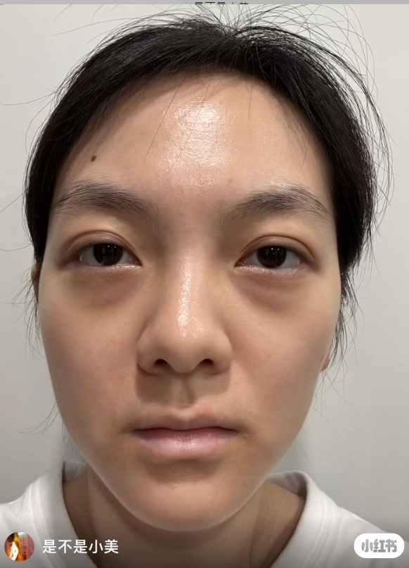 早睡早起丨23歲女實測「早睡挑戰」 每晚11點前入睡 堅持4年效果驚人 靚到被質疑是醫美 早睡早起丨23歲女實測「早睡挑戰」 每晚11點前入睡 堅持4年效果驚人 靚到被質疑是醫美